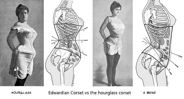 Edwardian S bend corset vs traditional hourglass corset